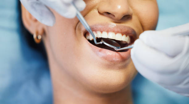 Best Dentist for Tooth Abscess  in Minonk, IL